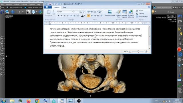 РАЗБОР КТ С КОНТРАСТОМ . смотреть онлайн