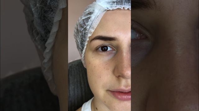 Ламинирование ресниц | до после смотреть онлайн