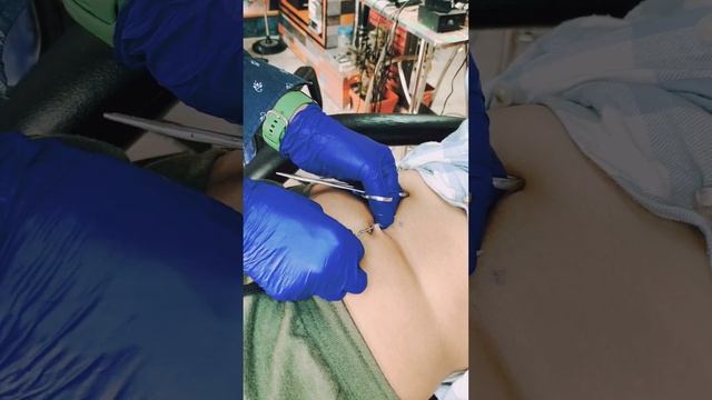 Navel piercing''', a type of piercing located through the skin of the navel. смотреть онлайн