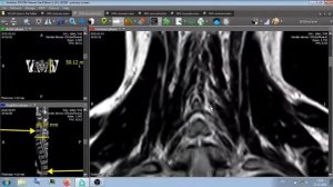 МРТ "ОБСЛЕДОВАНИЕ" ГОЛОВЫ И ШЕИ .