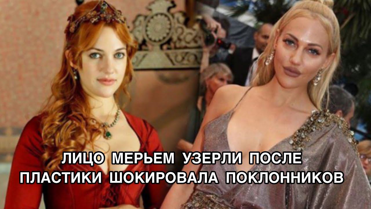 ЛИЦО МЕРЬЕМ УЗЕРЛИ ПОСЛЕ ПЛАСТИКИ ШОКИРОВАЛО ПОКЛОННИКОВ. Meryem Uzerli. Турецкие актёры .