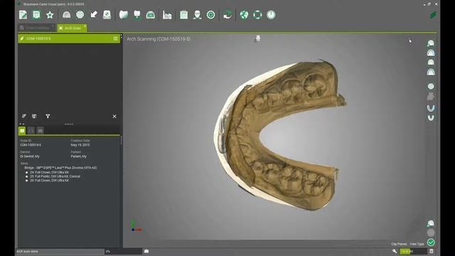 Virtual Articulator Part 2 - Scan