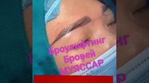 Броулифтинг Бровей                           Эффект приподнявщих  бровей            Отрытый взгляд