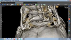 АРТЕРИИ ШЕИ И ГОЛОВЫ .