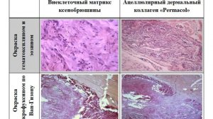 Лекция  Применение ВМК для пластики передней брюшной стенки