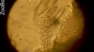 Инфузория стилонихия