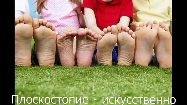 Плоскостопие - искусственно создаваемый дефект (Беседа первая)