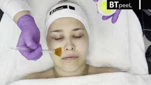 Процедура Зеленый пилинг с пептидами и экстрактом крапивы (двухфазный) BTpeeL (сокращённая версия)