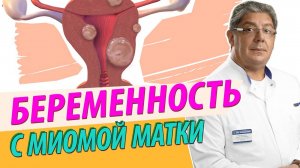 БЕРЕМЕННОСТЬ С МИОМОЙ МАТКИ. Советы и рекомендации. Беременная матка и миоматозные узлы