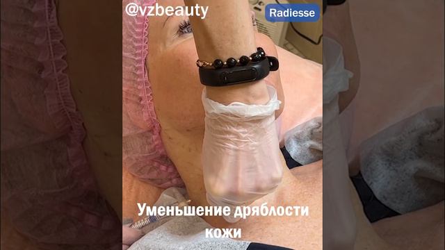 Укрепление кожи шеи препаратом Радиесс