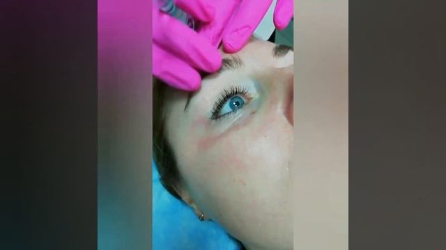 Lumi eyes Dermaren. Мезотерапия кожи вокруг глаз. Астапьева Оксана