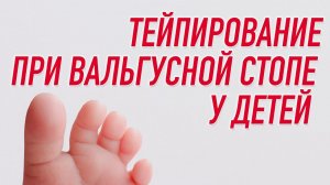 ✅ ТЕЙПИРОВАНИЕ ПРИ ВАЛЬГУСНОЙ СТОПЕ У ДЕТЕЙ | Наталья Суворова | Учебный центр BBALANCE