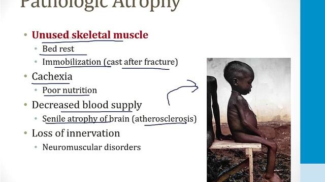 Патология USMLE - 1. Общие темы - 1.Клеточная адаптация