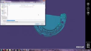 сопоставление файлов в Exocad