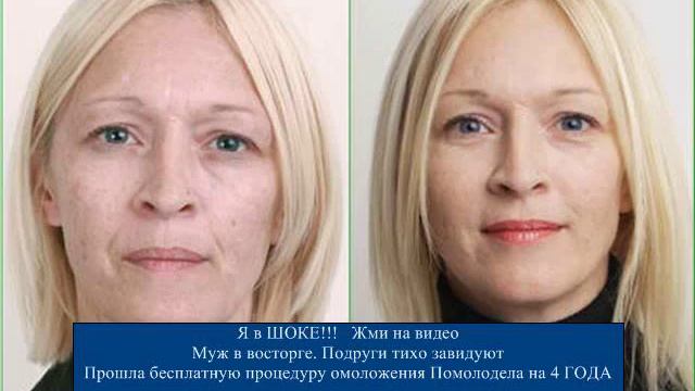 15. Гимнастика Для Лица И Шеи. Убираем Морщины Вокруг Губ [Морщины Вокруг Рта]