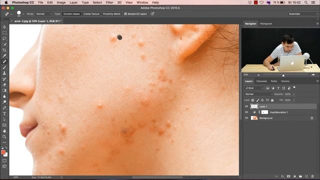 Как избавиться от прыщей в фотошопе за 5 минут!