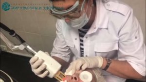 Лазерная шлифовка лица CO2. Фракционный фототермолиз. Показания, противопоказания, эффект, методика