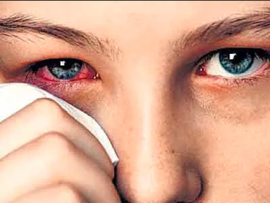 БРЕВНО И СОРИНКА