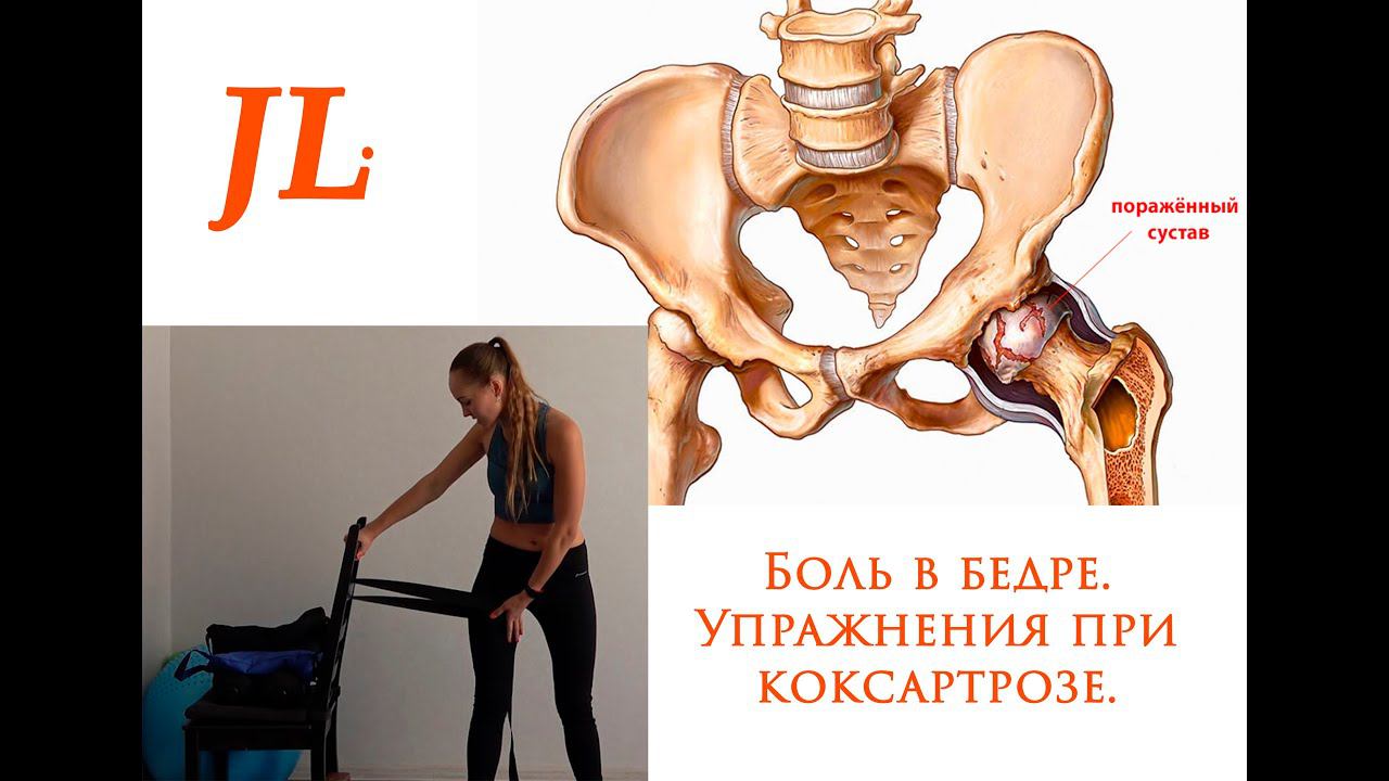 Упражнения при коксартрозе