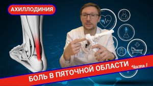 ПОЧЕМУ БОЛИТ В ОБЛАСТИ ПЯТКИ? АХИЛЛОДИНИЯ. (Часть 1)