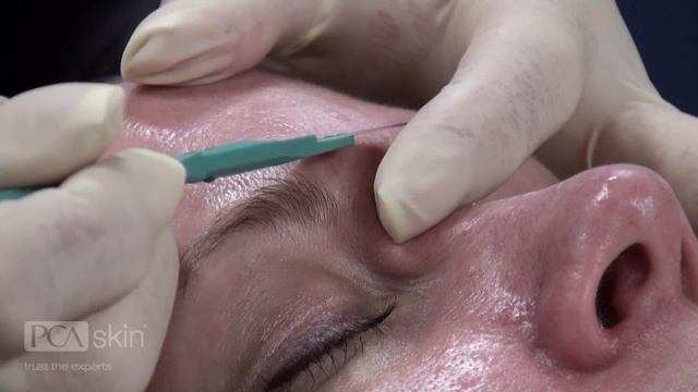 Dermaplaning & PCA SKIN Professional Treatments