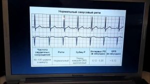 Теплый пол экономия на электричестве
