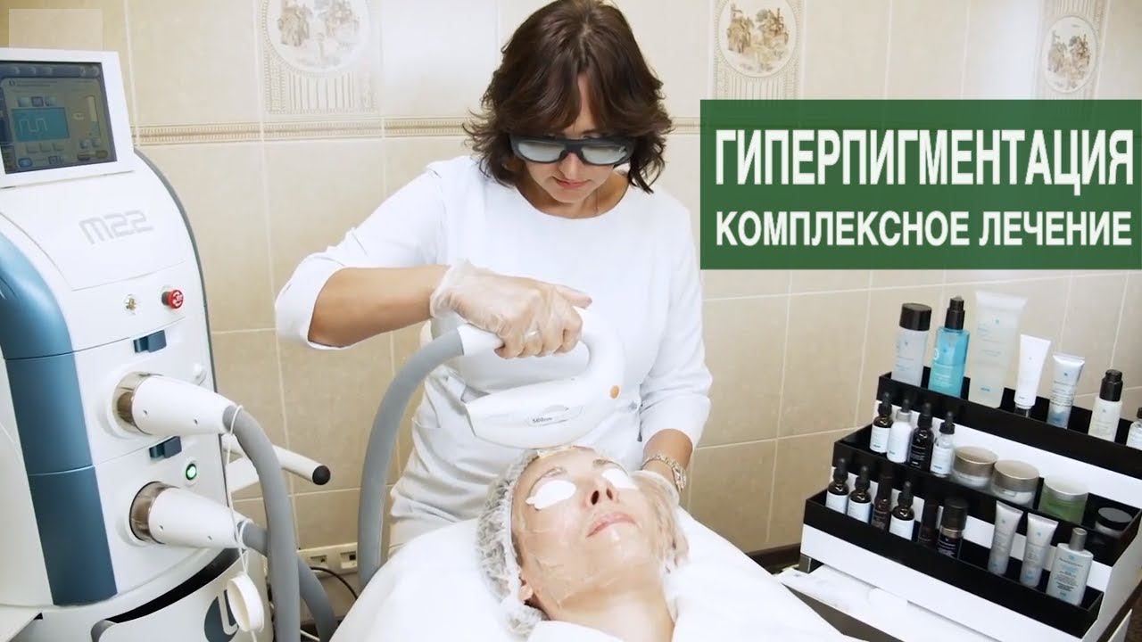 ГИПЕРПИГМЕНТАЦИЯ КОЖИ - комбинированное лечение. IPL-терапия и профессиональные средства.