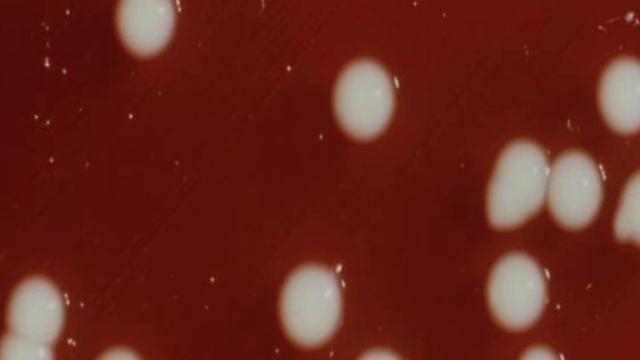 Klebsiella