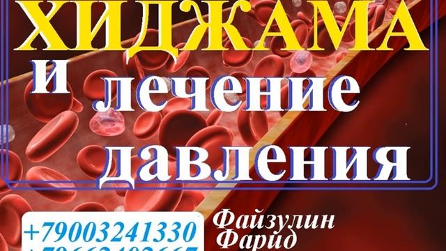 Хиджама и анемия  Обучение хиджаме Alhajam.ru