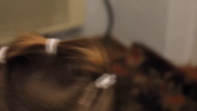 Как Ире вырывали зуб :D смотреть онлайн