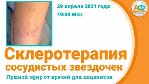 Склеротерапия сосудистых звездочек