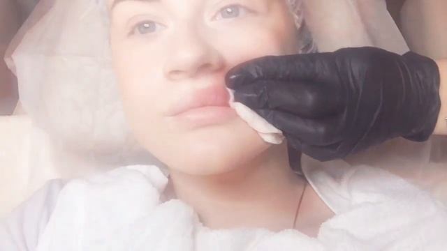 Мой поход к косметологу?? смотреть онлайн