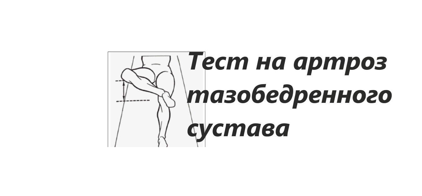 Артроз тазобедренного сустава евдокименко. Тест на тазобедренный сустав. Торсунов артроз тазобедренного. Артроз тазобедренного сустава симптомы и лечение у женщин.