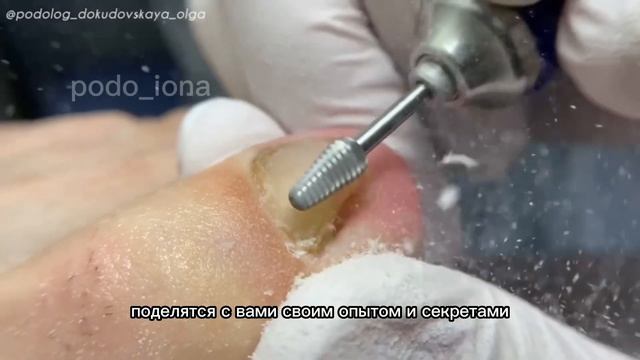 БЕСПЛАТНЫЙ ИНТЕНСИВ #подология #маникюр #курсыпедикюра #педикюр #наращиваниеногтей #дизайнногтей