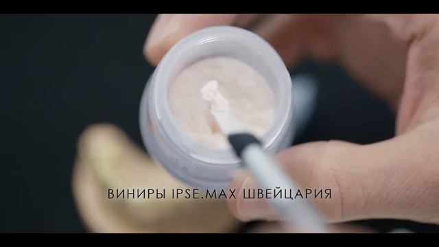 Виниры IPSE.MAX Швейцари в стоматологии ФлагманСтом - Казань