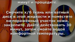 Как избавиться от сосудистой сетки, варикоза, плохой циркуляции крови, тяжести в ногах и усталости!