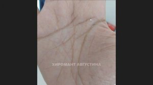 Разрыв на линии головы. Линия ума из двух частей. Линии на ладони. Хиромантия