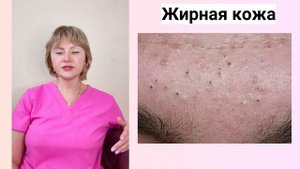типы кожи