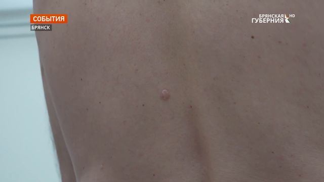 В Брянском кожвендиспансере освоили новое диагностическое оборудование смотреть онлайн