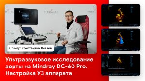 Ультразвуковое исследование аорты на Mindray DC-60 Pro. Настройка УЗ аппарата