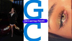 Лазерная коррекция зрения метод Ласик.