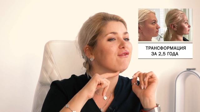 Как сделать выразительные скулы? Контурная пластика средней трети лица