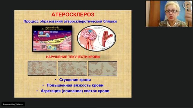 Вебинар | Пожилые люди не обуза, а ресурс страны | Курочкина ЕР смотреть онлайн