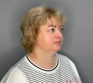 Мешки под глазами или грыжи: консультация пластического хирурга Алексея Маляева.