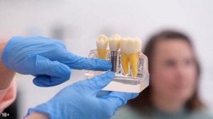 Ошибки стоматологов при протезировании зубов