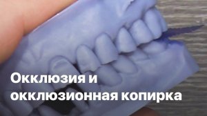 Окклюзия и окклюзионная копирка, окклюзионные контакты, проверка окклюзии копирка 8 микрон