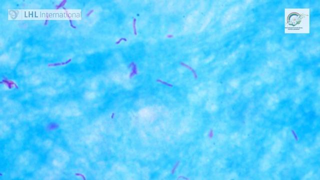 исследование мокроты смотреть онлайн