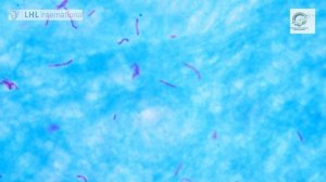 исследование мокроты