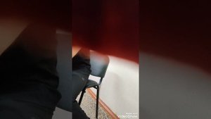 Что же все таки со швом после аппендицита ?. Как лечить дальше ? Легатурный свищь. ч 2