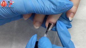 Загноился заусенец / Панариций последствия ?